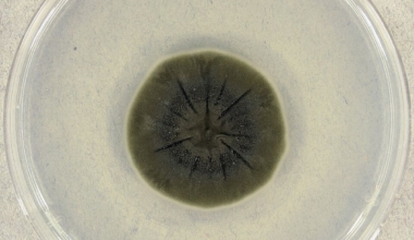 Cladosporium sphaerospermum  Foto: Medmyco/ Wikimedia