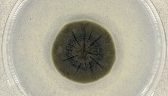 Cladosporium sphaerospermum Foto: Medmyco/ Wikimedia